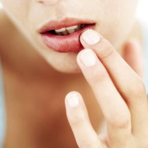 Des remèdes efficaces pour les rhumes sur les lèvres