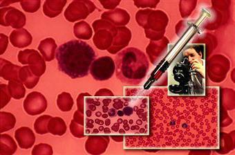 Une faible hémoglobine est un symptôme d'une maladie dangereuse?